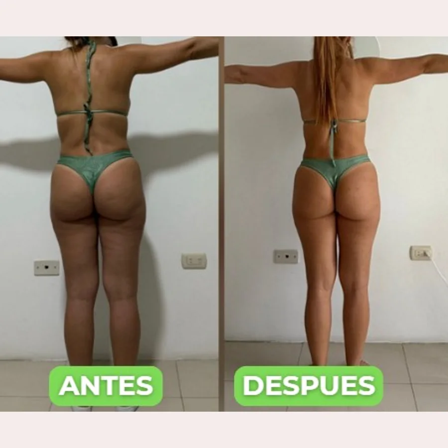 Antes y después de una alumna de Katherin (espalda)