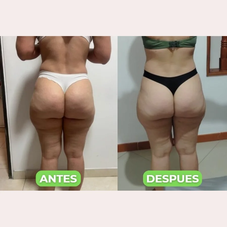 Antes y después de una alumna de Katherin (espalda)
