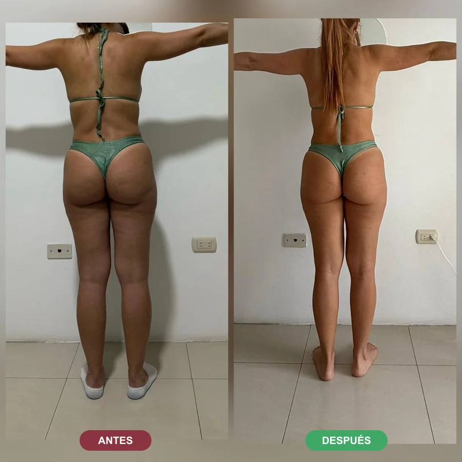 Antes y después de una alumna de Katherin (espalda)