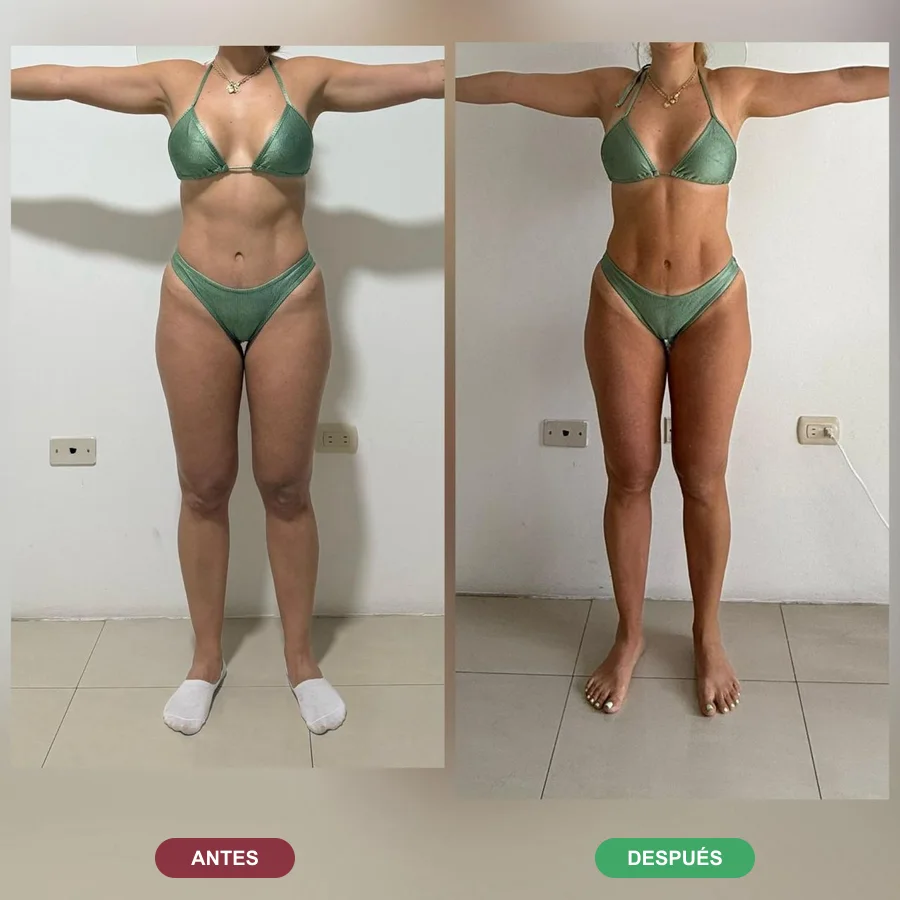Antes y después de una alumna de Katherin (frente)